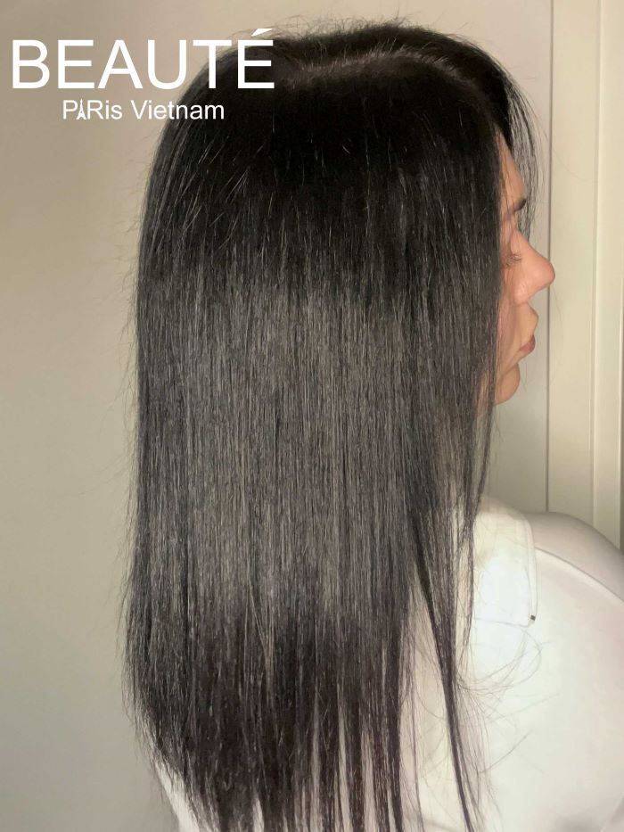 Review sản phẩm siêu phục hồi tóc hư tổn cấp phân tử L’Oréal Absolut Repair Molecular